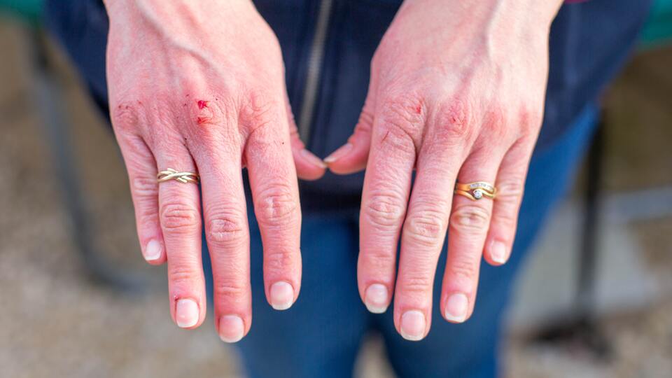 Dikkat! Koronanın bir belirtisi olabilir...