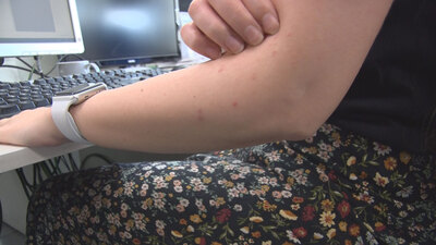 Bu uyarıya dikkat! Kanserden, beyin hasarına birçok hastalığın nedeni...