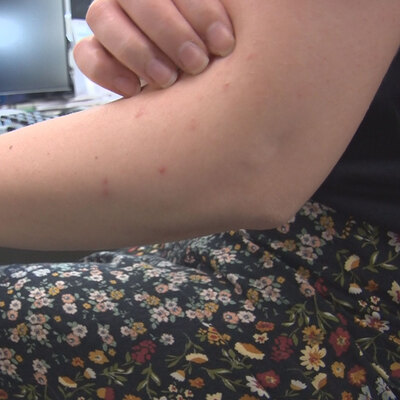 Bu uyarıya dikkat! Kanserden, beyin hasarına birçok hastalığın nedeni...