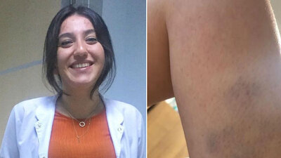 "Bana bakmak zorundasın!" Kovid-19 hastası hekime saldırdı!