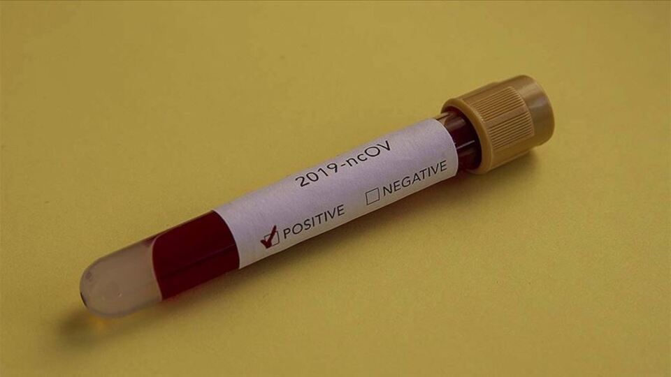 En güncel koronavirüs tablosu!