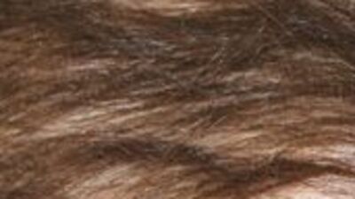 Hayatı 240 bin TL'ye bağlı