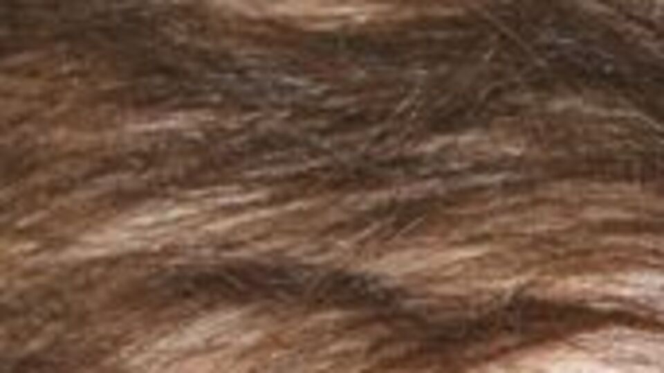 Hayatı 240 bin TL'ye bağlı