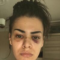 Sokak ortasında önce taciz ardından darp!