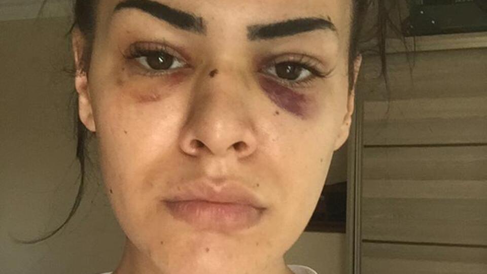 Sokak ortasında önce taciz ardından darp!