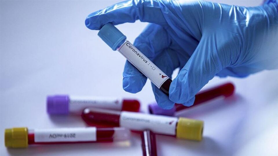 Covid-19'un erkek üreme fonksiyonlarına etkisi