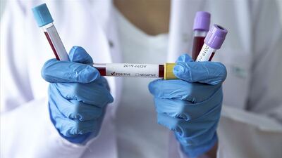 Bazı çocukların kanlarında hem Covid-19 hem de antikorlar aynı anda bulunuyor