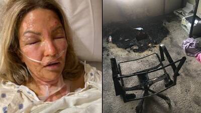 Dezenfektan sonrası mum yaktı bu hale geldi!