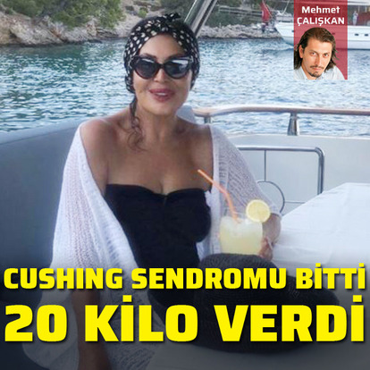 Cushing Sendromu bitti 20 kilo verdi