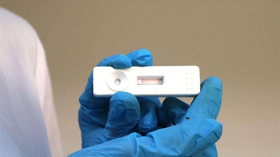 8 dakikada koronavirüs tanısı koyan kit geliştirildi