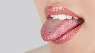 Dil yanması nedenleri ve tedavisi