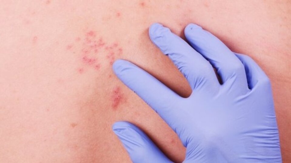 Gece yanığı nedenleri ve tedavi yöntemleri