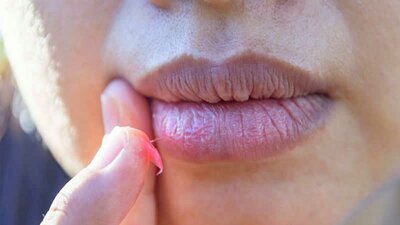 Dudak morarmasına neden olan etkenler