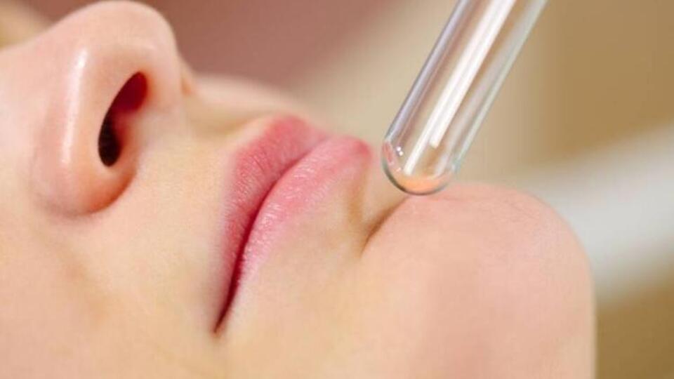 Lazer peeling uygulaması ve kullanım alanları