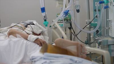 Kovid-19 o kişilerde daha ağır seyredebiliyor