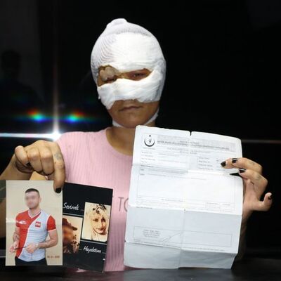 Sevgilisi başında 4 şişe kırdı! 7 saat işkence!