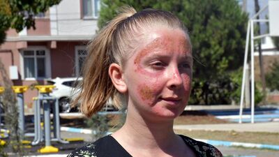 Cilt bakımı kâbusa döndü!