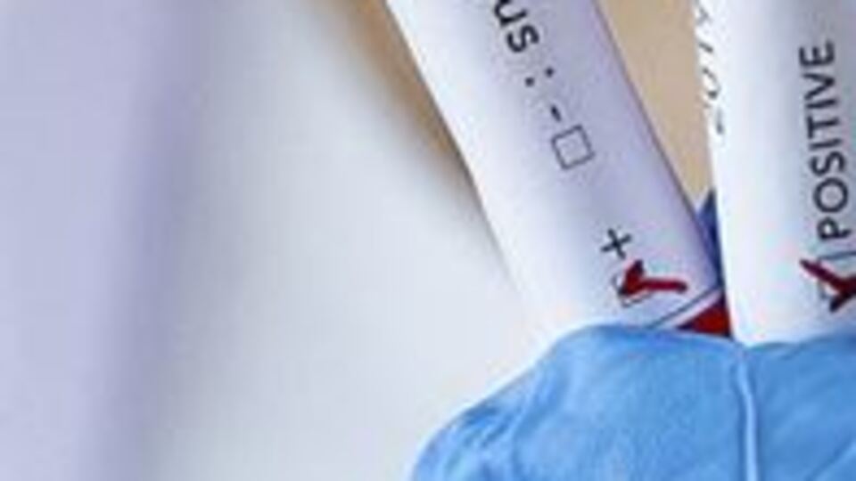 Maskesiz teste soruşturma açıldı