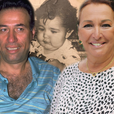 "Hiç delik yanaklı bebek görmemiştim"