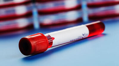 Trombosit yüksekliği belirtileri ve tedavisi