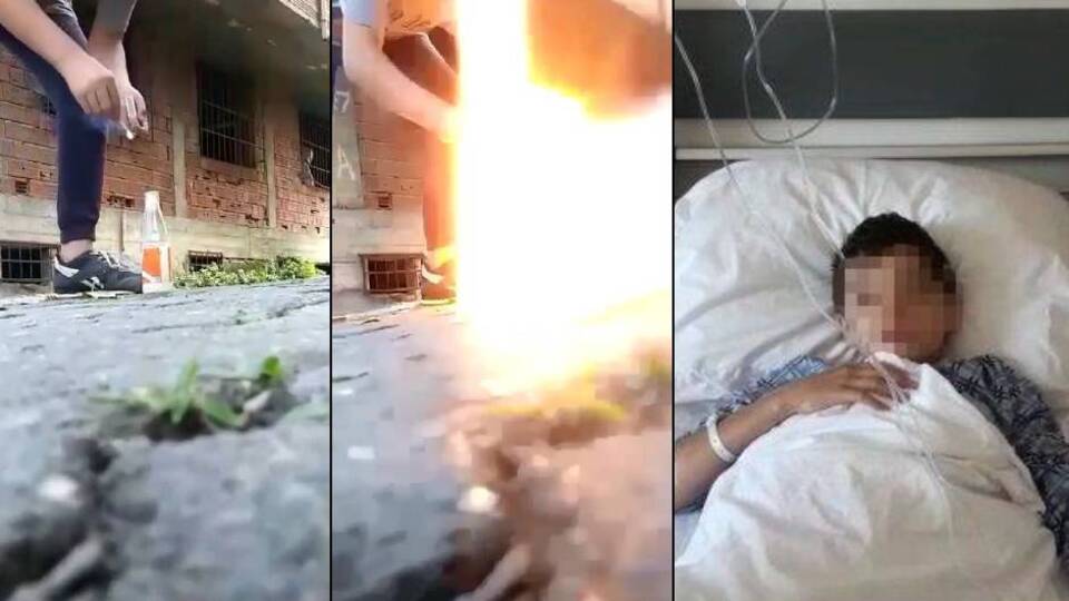 Çocuğu gözünü kaybeden babanın 'torpil' isyanı