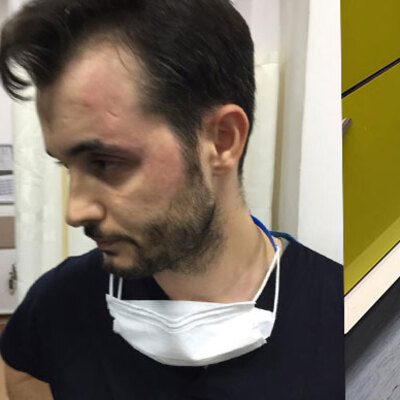 5 kişi saldırdı! Cerrahi makası saplamaya çalıştı!