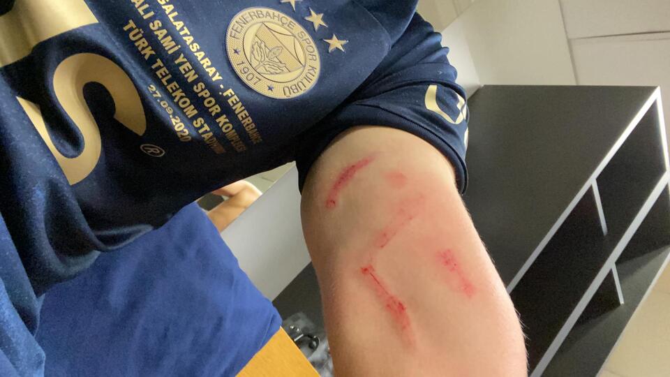 Derbide tartışmalı pozisyonlar