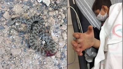 Engerek dehşeti! Civan yoğun bakımda