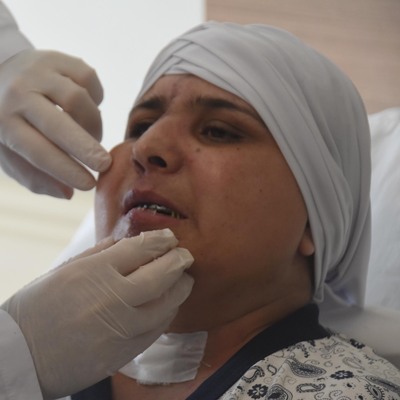 İnanılmaz olay! Kazada yüzü ikiye ayrılmıştı...