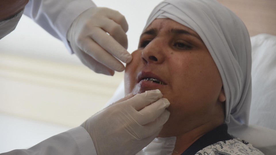 İnanılmaz olay! Kazada yüzü ikiye ayrılmıştı...