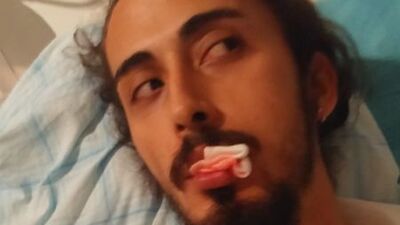 Tıp öğrencisi sahilde gitar çaldı! Çenesini kırdılar!