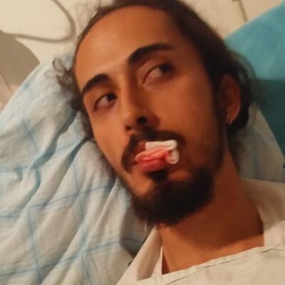 Tıp öğrencisi sahilde gitar çaldı! Çenesini kırdılar!