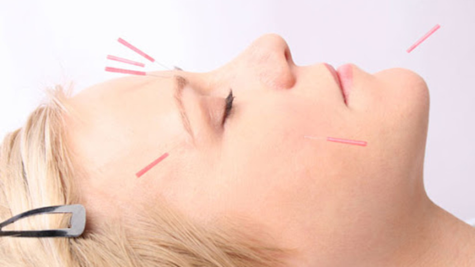 Yüz akupunkturu uygulanan bölgeler