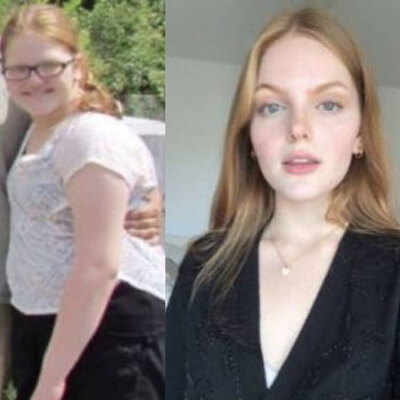 Ergenlik fotoğraflarını paylaştılar... Büyük değişim!