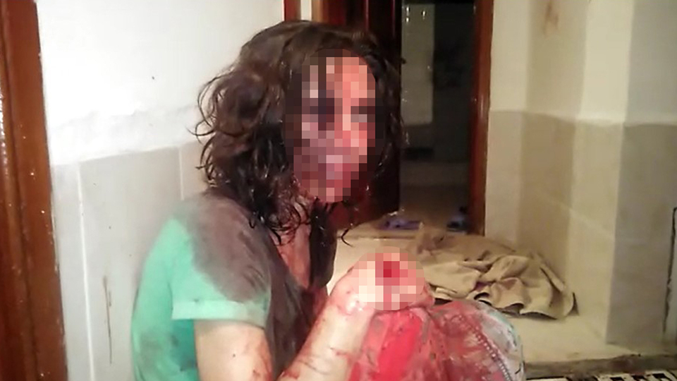 Polis balkondan girip kurtardı! Eli yüzü kanlar içinde bulundu!