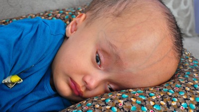 Sevindiren haber! Cumhurbaşkanı'nın talimatıyla tedaviye alınmıştı