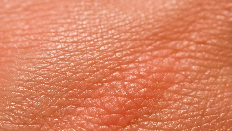 Bilim insanları açıkladı! Deride 9 saate kadar...