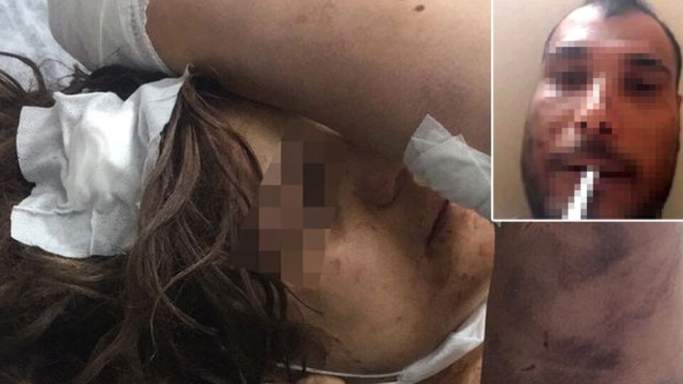 Akılalmaz olay! Eşini zincirle dövüp tırnaklarını çekti!