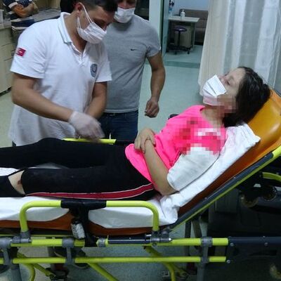 Samsun'da dehşet! Küçük kıza 3 pitbull saldırdı!