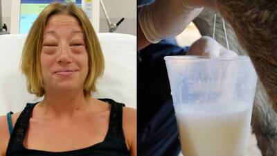 Eşek sütü içti, ölümden döndü!