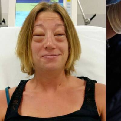 Eşek sütü içti, ölümden döndü!