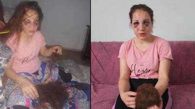 Koca dehşeti! Saçlarını yoldu