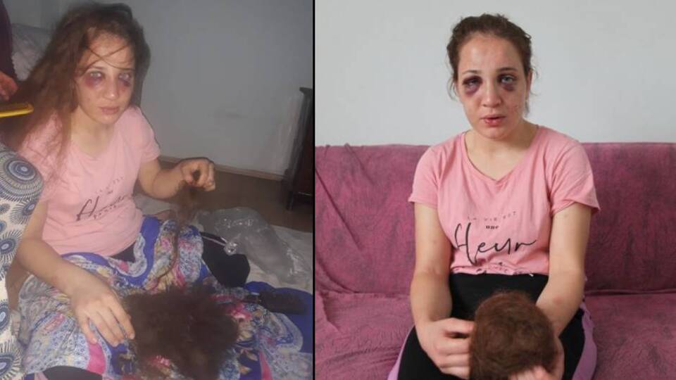 Koca dehşeti! Saçlarını yoldu