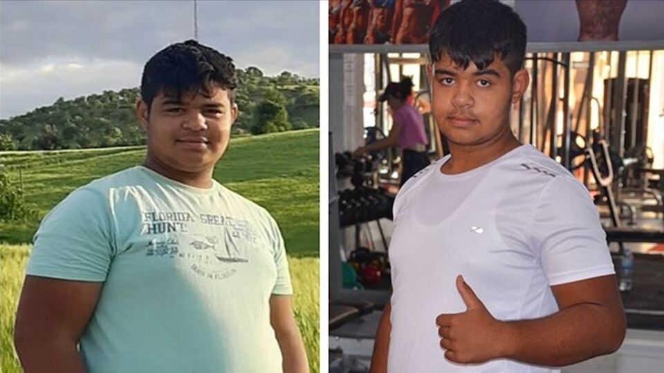 Nefes almakta zorlanınca 3 ayda 23 kilo verdi