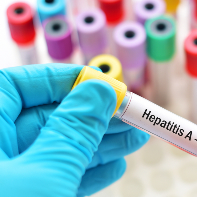 Hepatit A nedir?