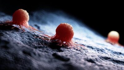 Kanser risk faktörleri nelerdir?