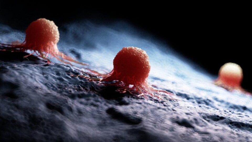 Kanser risk faktörleri nelerdir?