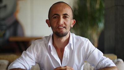 Doğumsal anomaliye karşı mücadelesiyle diğer hastalara umut oluyor