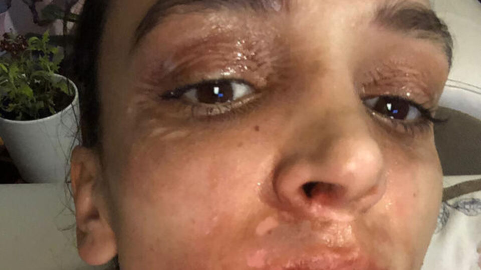 1,5 milyon lira tazminat istiyor!