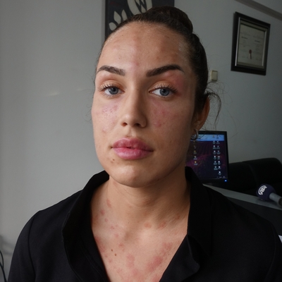 'Gençlik aşısı' bu hale getirdi!